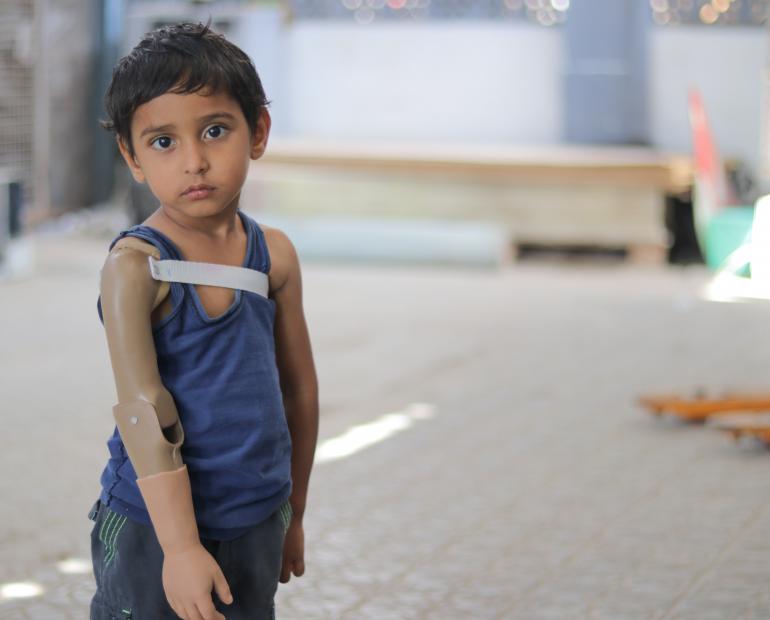 Rayan, now three years old, lost his arm last year when fighting escalated in Aden. He visits the prosthetics centre at a hospital in Yemen.