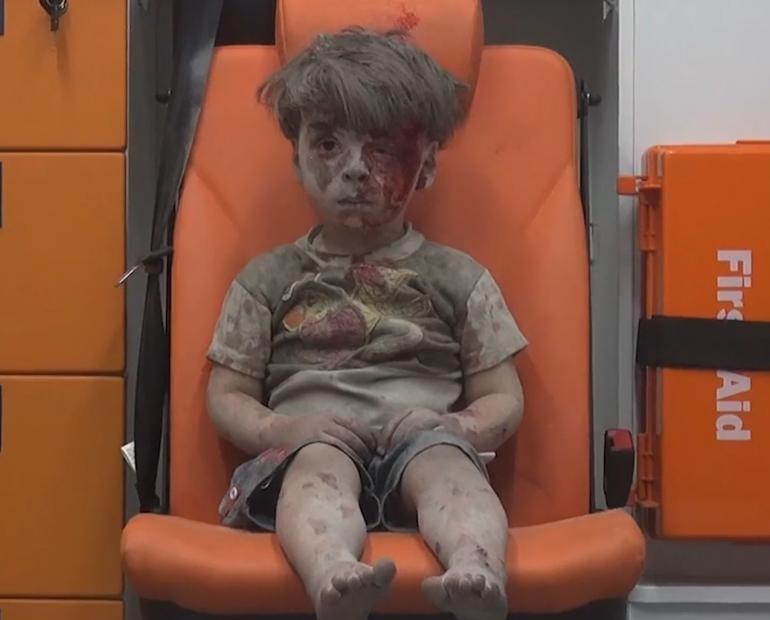 Omran sitting on an orange ambulance chair terrified with his face covered by dust and blood